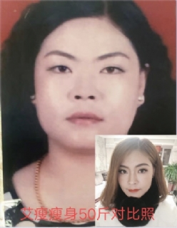 艾瘦故事1.jpg